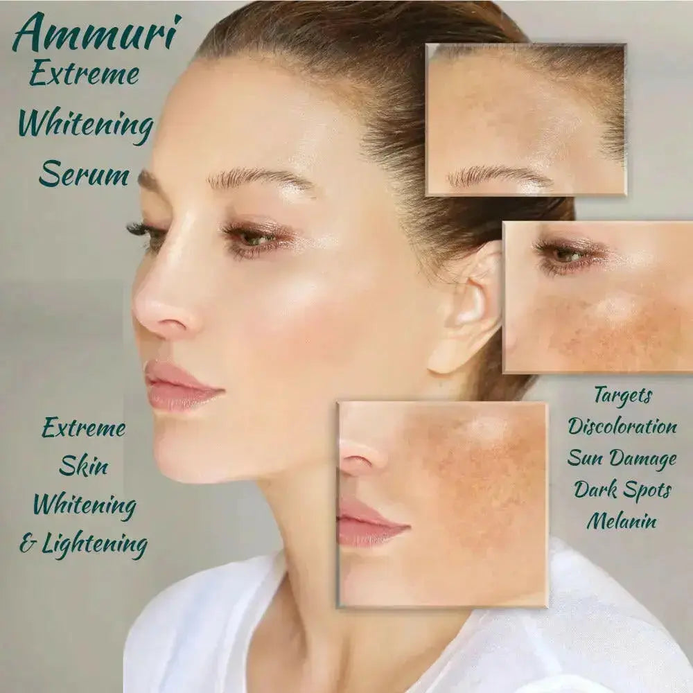 Intense Dark Spot Corrector Serum for Face, Neck & Body (30ml) | Ammuri